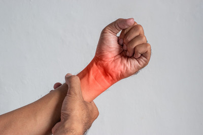 Carpal Tunnel Syndrome